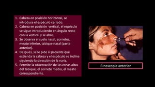 1. Cabeza en posición horizontal, se
introduce el espéculo cerrado.
2. Cabeza en posición vertical, el espéculo
se sigue introduciendo en ángulo recto
con la vertical y se abre.
3. Se observa el suelo nasal, cornetes,
meato inferior, tabique nasal (parte
anterior).
4. Después, se le pide al paciente que
extienda la cabeza y el espéculo se inclina
siguiendo la dirección de la nariz.
5. Permite la observación de las zonas altas
del tabique, el cornete medio, el meato
correspondiente.
Rinoscopia anterior
 