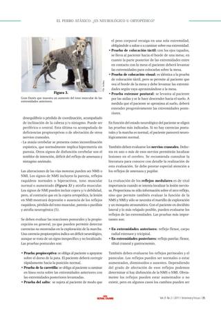 Figura 3.
Gran Danés que muestra un aumento del tono muscular de las
extremidades anteriores.

desequilibrio o pérdida de coordinación, acompañado
de inclinación de la cabeza y/o nistagmo. Puede ser
periférica o central. Esta última va acompañada de
deficiencias propioceptivas o de afectación de otros
nervios craneales.
- La ataxia cerebelar se presenta como incoordinación
espástica, que normalmente implica hipermetría sin
paresia. Otros signos de disfunción cerebelar son el
temblor de intención, déficit del reflejo de amenaza y
nistagmo anómalo.
Las alteraciones de las vías motoras pueden ser NMS o
NMI. Los signos de NMS incluyen la paresia, reflejos
raquídeos normales o hiperactivos, tono muscular
normal o aumentado (Figura 3) y atrofia muscular.
Los signos de NMI pueden incluir cojera y/o debilidad,
pero, al contrario que en la cojera ortopédica, la lesión
en NMI mostrará depresión o ausencia de los reflejos
raquídeos, pérdida del tono muscular, paresia o parálisis
y atrofia neurogénica (5).
Se deben evaluar las reacciones posturales y la propiocepción en general, ya que pueden permitir detectar
carencias no mostradas en la exploración de la marcha.
Una carencia propioceptiva indica un déficit neurológico,
aunque se trata de un signo inespecífico y no localizado.
Las pruebas posturales son:
• Prueba propioceptiva: se obliga al paciente a apoyarse
sobre el dorso de la pata. El paciente deberá corregir
rápidamente hacia la posición normal.
• Prueba de la carretilla: se obliga al paciente a caminar
en línea recta sobre las extremidades anteriores con
las extremidades posteriores levantadas.
• Prueba del salto: se sujeta al paciente de modo que

© Dr. Artiles.

EL PERRO ATÁXICO: ¿ES NEUROLÓGICO U ORTOPÉDICO?

el peso corporal recaiga en una sola extremidad,
obligándole a saltar o a caminar sobre esa extremidad.
• Prueba de colocación táctil: con los ojos tapados,
se lleva al paciente hacia el borde de una mesa; en
cuanto la parte posterior de las extremidades entre
en contacto con la mesa el paciente deberá levantar
las extremidades para colocarlas sobre la mesa.
• Prueba de colocación visual: es idéntica a la prueba
de colocación táctil, pero se permite al paciente que
vea el borde de la mesa y debe levantar las extremidades según vaya aproximándose a la mesa.
• Prueba extensor postural: se levanta al paciente
por las axilas y se le hace descender hacia el suelo. A
medida que el paciente se aproxima al suelo, deberá
extender progresivamente las extremidades posteriores.
En función del estado neurológico del paciente se eligen
las pruebas más indicadas. Si no hay carencias posturales y la marcha es normal, el paciente parecerá neurológicamente normal.
También deben evaluarse los nervios craneales. Defectos en uno o más de esos nervios permitirán localizar
lesiones en el cerebro. Se recomienda consultar la
literatura para conocer con detalle la realización de
esta evaluación. Se debe prestar especial atención a
los reflejos de amenaza y pupilar.
La evaluación de los reflejos medulares es de vital
importancia cuando se intenta localizar la lesión nerviosa. Proporciona no sólo información sobre el arco reflejo,
sino que permite también evaluar la función de la
NMS y NMI y sólo se necesita el martillo de exploración
y un mosquito atraumático. Con el paciente en decúbito
lateral y lo más relajado posible, pueden evaluarse los
reflejos de las extremidades. Las pruebas más importantes son:
• En extremidades anteriores: reflejo flexor, carpo
radial extensor y tricipital.
• En extremidades posteriores: reflejo patelar, flexor,
tibial craneal y gastrocnemio.
También deben evaluarse los reflejos perineales y el
panicular. Los reflejos pueden ser normales o estar
aumentados, disminuidos o ausentes. Dependiendo
del grado de afectación de esos reflejos podemos
determinar si hay disfunción de la NMS o NMI. Obviamente los reflejos pueden estar aumentados o no
existir, pero en algunos casos los cambios pueden ser

Vol 21 No 2 / 2011 / Veterinary Focus / 35

 