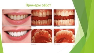 Примеры работ
 