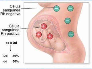 dd x Dd

Dd

50%

dd

50%

 