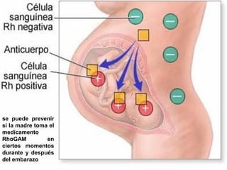 se puede prevenir
si la madre toma el
medicamento
RhoGAM
en
ciertos momentos
durante y después
del embarazo

 