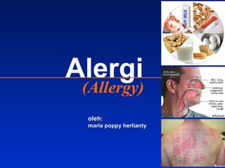 (Allergy) Alergi oleh : maria poppy herlianty  