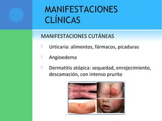 MANIFESTACIONES
CLÍNICAS
 MANIFESTACIONES CUTÁNEAS
 Urticaria: alimentos, fármacos, picaduras
 Angioedema
 Dermatitis atópica: sequedad, enrojecimiento,
descamación, con intenso prurito
 