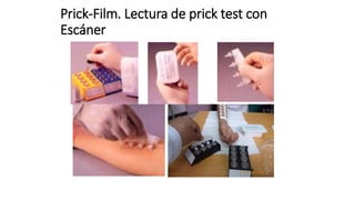 Prick-Film. Lectura de prick test con
Escáner
 