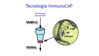 Tecnología ImmunoCAP
CAP System™
ImmunoCAP®
 
