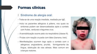  Síndrome de alergia oral:
- Trata-se de uma reação imediata, mediada por IgE.
- Inclui os pacientes alérgicos à pólens, nos quais os
sintomas podem ser desencadeados após o contato
com frutas, verduras e legumes crus.
- A sensibilização ocorre pela via respiratória (classe II).
- Frutas com reação cruzada com látex (banana, kiwi).
- Manifestações ocorrem logo após o contato com o
alérgenos: angioedema, prurido, formigamento da
língua, obstrução de vias aéreas. Mais comum em
crianças maiores.
Formas clínicasFormas clínicas
 
