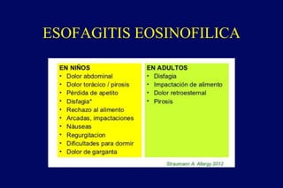 ESOFAGITIS EOSINOFILICA
 