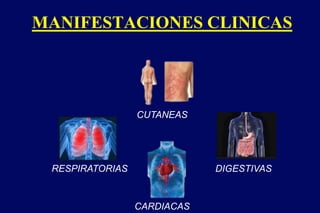 MANIFESTACIONES CLINICAS
CUTANEAS
DIGESTIVAS
CARDIACAS
RESPIRATORIAS
 