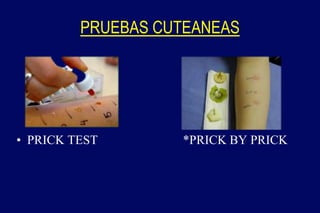PRUEBAS CUTEANEAS
• PRICK TEST *PRICK BY PRICK
 