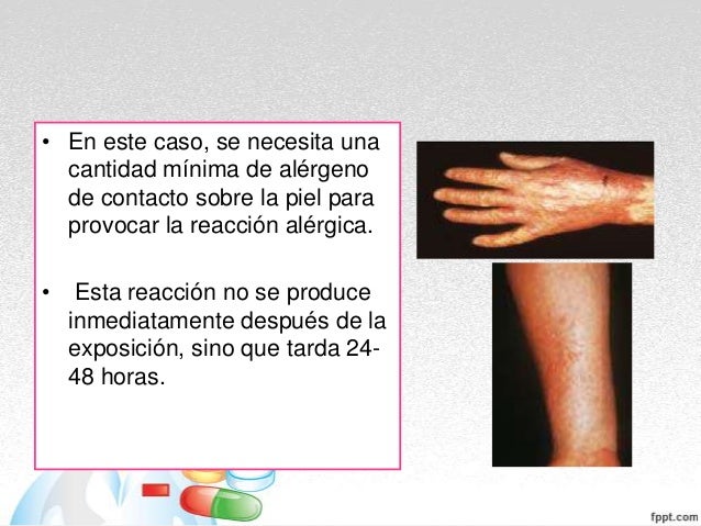 La eccema microbiana el tratamiento los síntomas