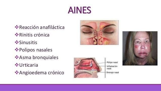 Alergia a medicamentos Alergia a medicamentos