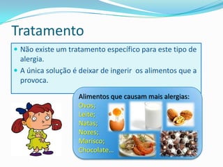 Tratamento
 Não existe um tratamento específico para este tipo de
  alergia.
 A única solução é deixar de ingerir os alimentos que a
  provoca.
                   Alimentos que causam mais alergias:
                   Ovos;
                   Leite;
                   Natas;
                   Nozes;
                   Marisco;
                   Chocolate…
 