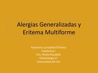 Alergias Generalizadas y
  Eritema Multiforme

     Giovanna Larrazábal D’Amico
             Exodoncia I
         Dra. Noela Rosadilla
           Odontología 6°
         Universidad del Sur
 