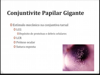 Conjuntivite Papilar Gigante
0 Estímulo mecânico na conjuntiva tarsal
0 LCG
0Depósito de proteínas e debris celulares
0 LCR
0 Prótese ocular
0 Sutura exposta
 