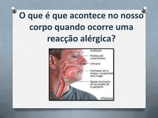 O que é que acontece no nosso
corpo quando ocorre uma
reacção alérgica?
 