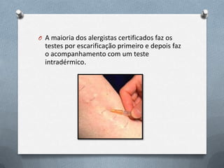 O A maioria dos alergistas certificados faz os
testes por escarificação primeiro e depois faz
o acompanhamento com um teste
intradérmico.
 