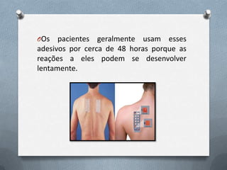 OOs   pacientes geralmente usam esses
adesivos por cerca de 48 horas porque as
reações a eles podem se desenvolver
lentamente.
 