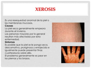 XEROSIS
Es una resequedad anormal de la piel o
las membranas mucosas.
Causas
La piel seca generalmente empeora
durante el invierno.
Las personas mayores por lo general
resultan más afectadas por esta
enfermedad.
Síntomas
Es posible que la piel se le ponga seca,
descamativa, pruriginosa y enrojecida e
igualmente puede presentar finas
cuarteaduras sobre ella.
El problema generalmente es peor en
las piernas y los brazos.
 