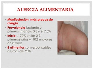 ALERGIA ALIMENTARIA
• Manifestación más precoz de
alergia.
• Prevalencia lactante y
primera infancia 0,3 y el 7,5%
• Inicio el 70% en los 2-3
primeros años y 10% mayores
de 8 años
• 8 alimentos son responsables
de más del 90%
 