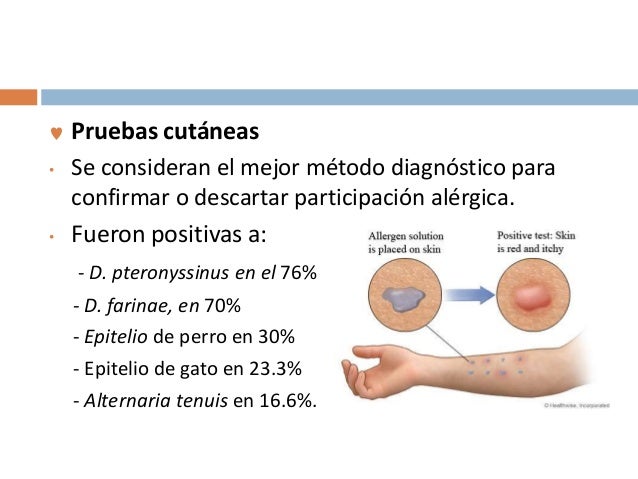 Que medios ayudan de la psoriasis