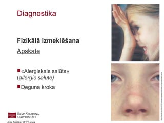 18
Anda Arbidāne, MF V 1.grupa
Fizikālā izmeklēšana
Apskate
«Alerģiskais salūts»
(allergic salute)
Deguna kroka
Diagnostika
https://quizlet.com/92630876/3-physical-assessment-nose-and-sinuses-flash-cards/
 