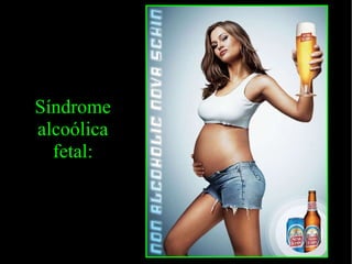 O Álcool e a família. Síndrome alcoólica fetal: 