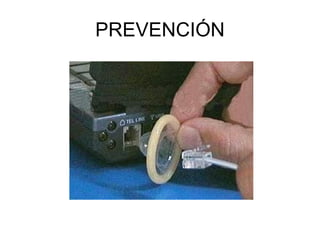 PREVENCIÓN 