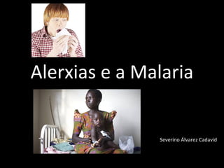 Alerxias e a Malaria Severino Álvarez Cadavid 