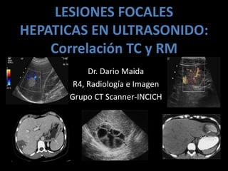 LESIONES FOCALES
HEPATICAS EN ULTRASONIDO:
    Correlación TC y RM
           Dr. Dario Maida
       R4, Radiología e Imagen
      Grupo CT Scanner-INCICH
 