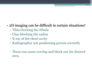 • 2D imaging can be difficult in certain situations!
▫ Tibia blocking the Fibula
▫ Ulna blocking the radius
▫ X-ray of the chest cavity
▫ Radiographer not positioning person correctly
▫ These can cause overlap and block out the desired
area.
 