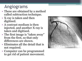 Angiograms
• These are obtained by a method
called subtraction technique.
• X-ray is taken and then
digitised.
• A contrast medium is then
injected, and another X-ray is
taken and digitised.
• The first image is “taken away”
from the first, so that only
differences are shown.
• Eliminates all the detail that is
not required.
• Computer can be programmed
to get rid of patient movement.
 