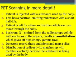 PET Scanning in more detail!
1. Patient is injected with a substance used by the body.
2. This has a positron-emitting radiotracer with a short
half-life.
3. Patient is left for a time so that the radiotracer can
move through the body.
4. Positrons (β+) emitted from the radioisotope collide
with electrons in the organs; results in annihilation
which gives off high energy gamma rays.
5. Detectors record these emissions and map a slice.
6. Distribution of radioactivity matches up with
metabolic activity because the substance is being
used by the body.
 