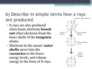 b) Describe in simple terms how x-rays
are produced.
• X-rays are also produced
when beam electrons knock
out other electrons from the
inner shells of the tungsten
atoms.
• Electrons in the atoms’ outer
shells move into the
vacancies in the lower
energy levels, and release
energy in the form of X-rays.
 