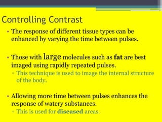 Controlling Contrast
• The response of different tissue types can be
enhanced by varying the time between pulses.
• Those with large molecules such as fat are best
imaged using rapidly repeated pulses.
▫ This technique is used to image the internal structure
of the body.
• Allowing more time between pulses enhances the
response of watery substances.
▫ This is used for diseased areas.
 