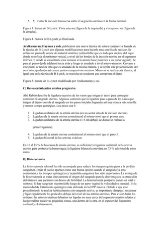 5. 5) Cerrar la incisión transversa sobre el segmento uterino en la forma habitual.
Figura 3. Sutura de B-Lynch. Vista anterior (figura de la izquierda) y vista posterior (figura de
la derecha).
Figura 4 . Sutura de B-Lynch ya finalizada.
Arulkumaran, Hayman y cols. publicaron una nueva técnica de sutura compresiva basada en
la técnica de B-Lynch con algunas modificaciones para hacerla más sencilla de realizar. Se
utiliza un punto de sutura de material sintético reabsorbible que es dado por encima del lugar
donde se refleja el peritoneo vesical, a nivel de los bordes de la incisión uterina en el segmento
inferior (o donde se encontraría esta incisión si la atonía fuese posterior a un parto vaginal). Se
pasa el punto desde adelante hacia atrás y luego es anudado a nivel antero-superior. Cercano a
este punto se realiza otro que es anudado de la misma manera, y se repite este procedimiento del
otro lado, quedando así cuatro puntos compresivos uterinos. Mientras se realiza esta técnica, al
igual que en la técnica de B-Lynch, se necesita un ayudante que comprima el útero.
Figura 5. Sutura de B-Lynch modificada por Arulkumaran y col.
C) Desvascularización uterina progresiva
Abd Rabbo describe la ligadura sucesiva de los vasos que irrigan el útero para conseguir
controlar el sangrado uterino. Algunos sostienen que la ligadura paso a paso de los vasos que
irrigan el útero controla el sangrado en los pasos iniciales logrando así una técnica más sencilla
y menor tiempo quirúrgico. Los pasos son 5:
1. Ligadura unilateral de la arteria uterina (en un sector alto de la incisión uterina).
2. Ligadura de la arteria uterina contralateral al mismo nivel que el primer paso
3. Ligadura unilateral de la arteria uterina (3-5 cm debajo de donde se realizó la
primer ligadura).
4. Ligadura de la arteria uterina contralateral al mismo nivel que el paso 3.
5. Ligadura bilateral de las arterias ováricas
En 10 al 15 % de los casos de atonía uterina, es suficiente la ligadura unilateral de la arteria
uterina para controlar la hemorragia; la ligadura bilateral controlará un 75 % adicional de estos
casos
D) Histerectomia
La histerectomía subtotal ha sido aconsejada para reducir los tiempos quirúrgicos y la pérdida
sanguínea. Dejar el cuello aparece como una buena opción cuando el sangrado ya está
controlado y los tiempos quirúrgicos y la pérdida sanguínea han sido importantes. La ventaja de
la histerectomía es tratar directamente el origen del sangrado pero la desventaja es la extracción
del útero en una paciente con deseos de fertilidad. La histerectomía postparto puede ser total o
subtotal. Si hay sangrado incontrolable luego de un parto vaginal la velocidad es esencial. Es la
modalidad de tratamiento quirúrgico más utilizada en la HPP masiva. Debido a que este
procedimiento se realiza habitualmente con sangrado activo, es importante clampear, seccionar
y ligar rápidamente los pedículos debajo del nivel de las arterias uterinas. Para evitar dañar los
uréteres, las arterias uterinas deberían ser ligadas no muy cerca del segmento uterino inferior y
luego realizar sucesivas pequeñas tomas, una dentro de la otra, en el espesor del ligamento
cardinal y el útero-sacro.
 