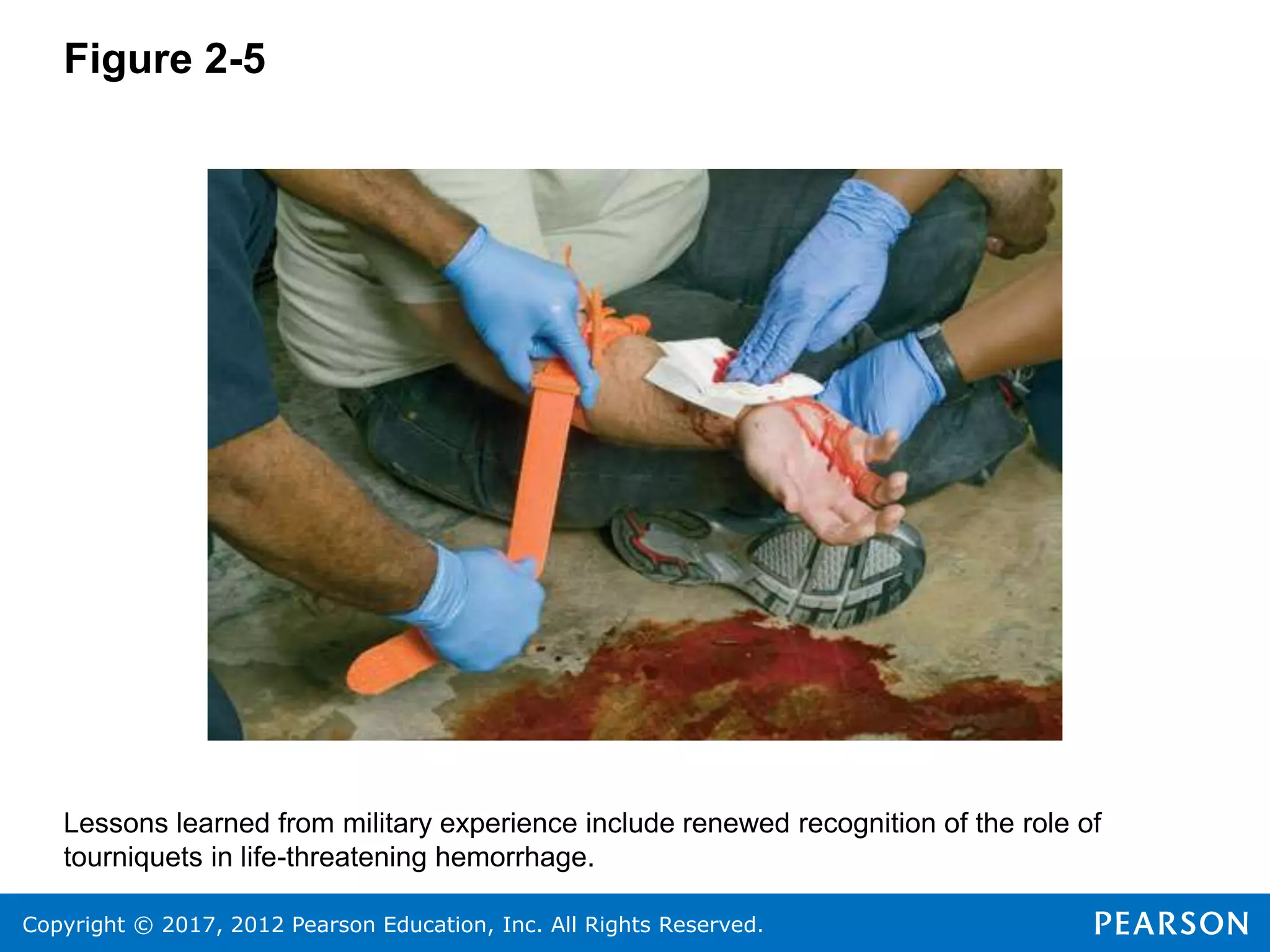 Copyright © 2017, 2012 Pearson Education, Inc. All Rights Reserved.
Figure 2-5
Lessons learned from military experience include renewed recognition of the role of
tourniquets in life-threatening hemorrhage.
 