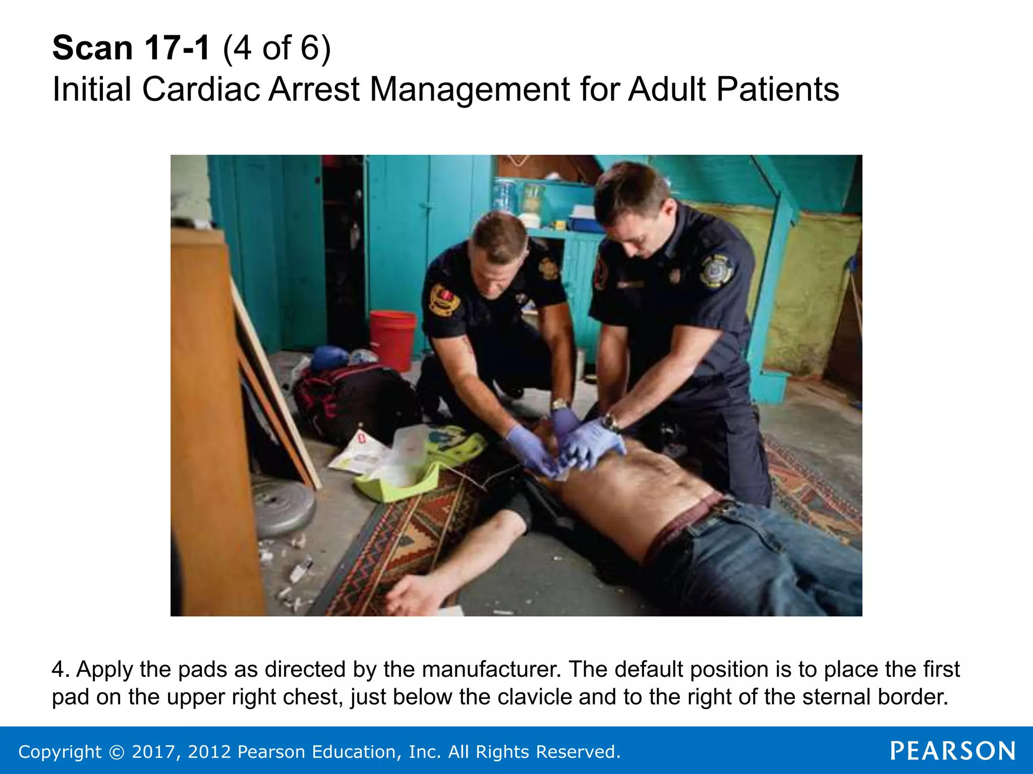 Copyright © 2017, 2012 Pearson Education, Inc. All Rights Reserved.
Scan 17-1 (4 of 6)
Initial Cardiac Arrest Management for Adult Patients
4. Apply the pads as directed by the manufacturer. The default position is to place the first
pad on the upper right chest, just below the clavicle and to the right of the sternal border.
 