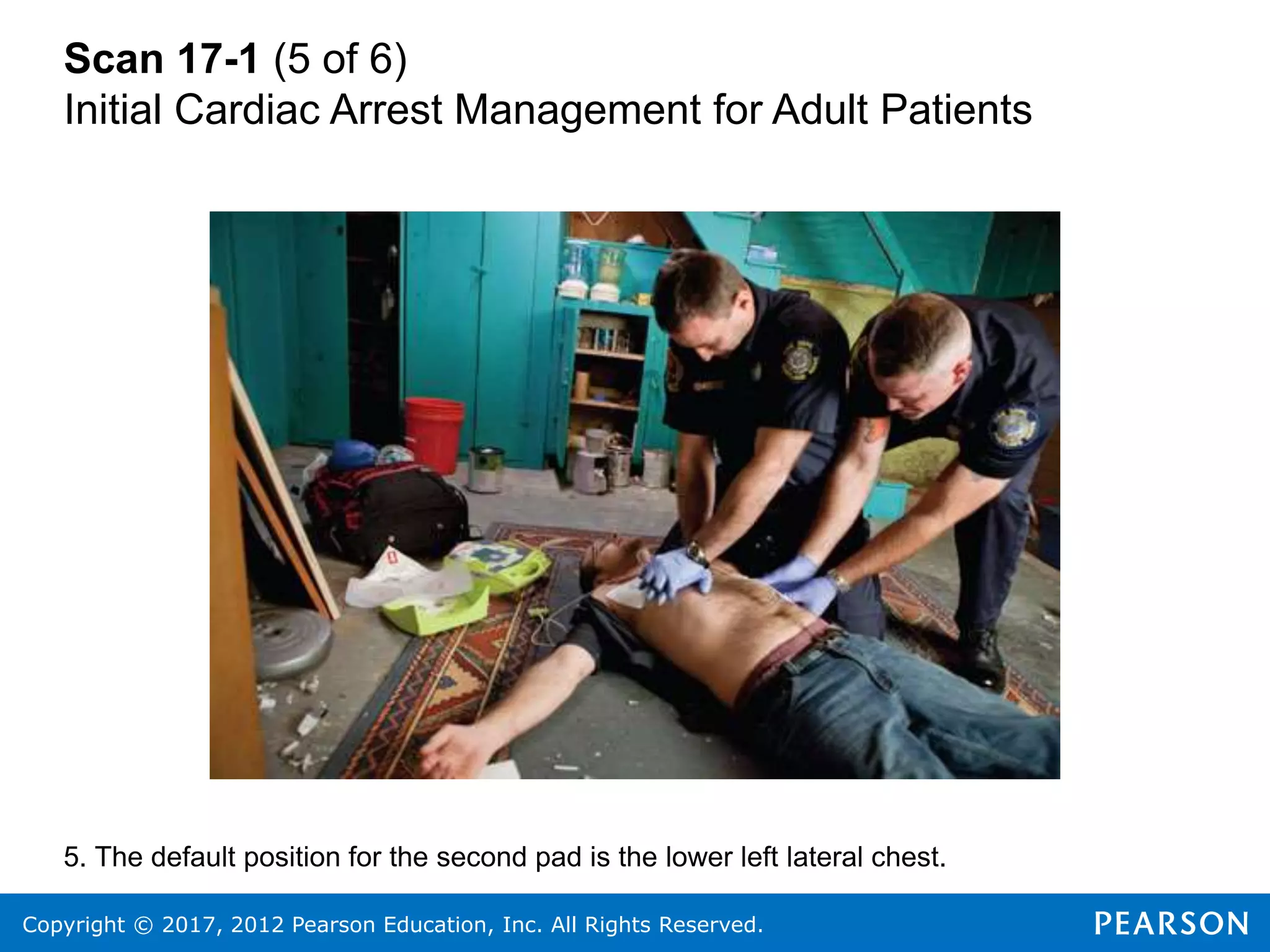 Copyright © 2017, 2012 Pearson Education, Inc. All Rights Reserved.
Scan 17-1 (5 of 6)
Initial Cardiac Arrest Management for Adult Patients
5. The default position for the second pad is the lower left lateral chest.
 