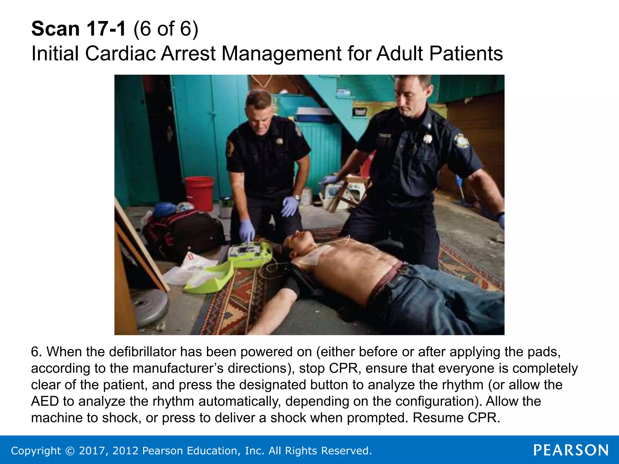 Copyright © 2017, 2012 Pearson Education, Inc. All Rights Reserved.
Scan 17-1 (6 of 6)
Initial Cardiac Arrest Management for Adult Patients
6. When the defibrillator has been powered on (either before or after applying the pads,
according to the manufacturer’s directions), stop CPR, ensure that everyone is completely
clear of the patient, and press the designated button to analyze the rhythm (or allow the
AED to analyze the rhythm automatically, depending on the configuration). Allow the
machine to shock, or press to deliver a shock when prompted. Resume CPR.
 