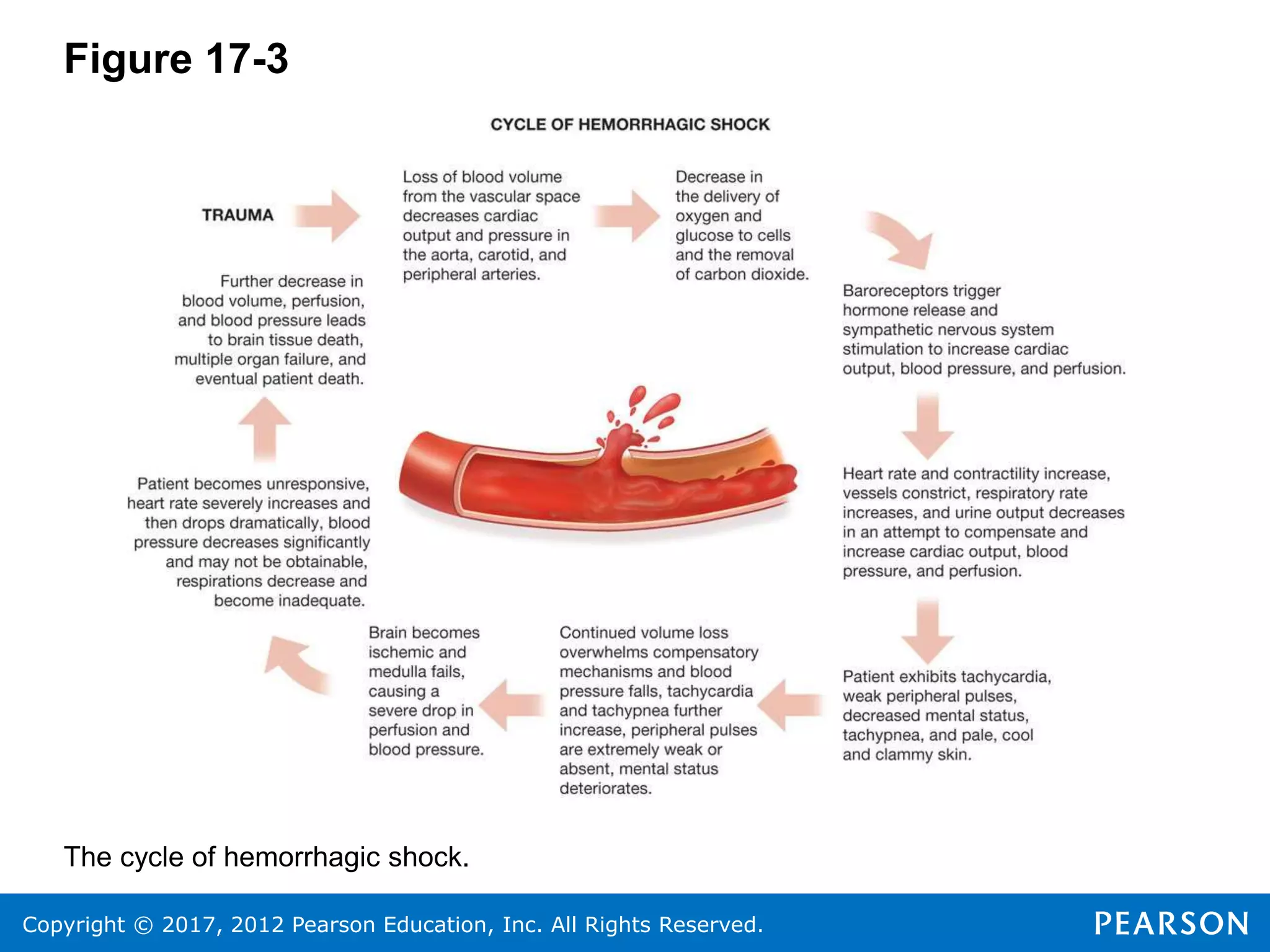 Copyright © 2017, 2012 Pearson Education, Inc. All Rights Reserved.
Figure 17-3
The cycle of hemorrhagic shock.
 