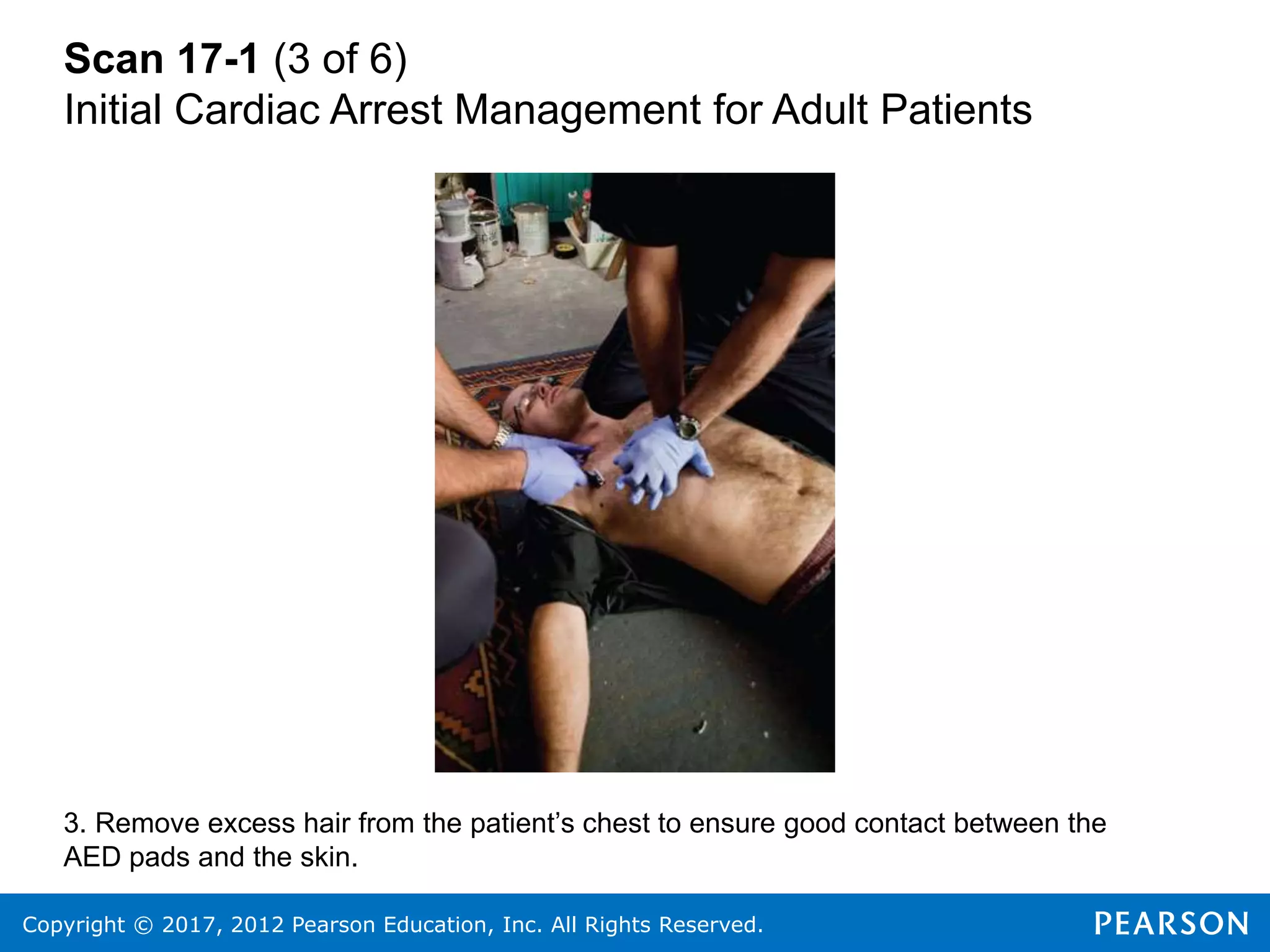 Copyright © 2017, 2012 Pearson Education, Inc. All Rights Reserved.
Scan 17-1 (3 of 6)
Initial Cardiac Arrest Management for Adult Patients
3. Remove excess hair from the patient’s chest to ensure good contact between the
AED pads and the skin.
 