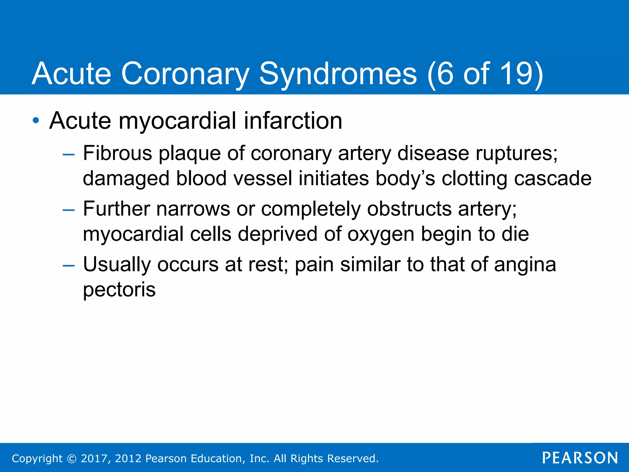 Copyright © 2017, 2012 Pearson Education, Inc. All Rights Reserved.
• Acute myocardial infarction
– Fibrous plaque of coronary artery disease ruptures;
damaged blood vessel initiates body’s clotting cascade
– Further narrows or completely obstructs artery;
myocardial cells deprived of oxygen begin to die
– Usually occurs at rest; pain similar to that of angina
pectoris
Acute Coronary Syndromes (6 of 19)
 