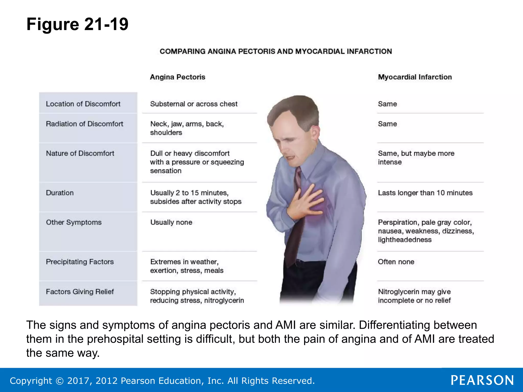 Copyright © 2017, 2012 Pearson Education, Inc. All Rights Reserved.
Figure 21-19
The signs and symptoms of angina pectoris and AMI are similar. Differentiating between
them in the prehospital setting is difficult, but both the pain of angina and of AMI are treated
the same way.
 