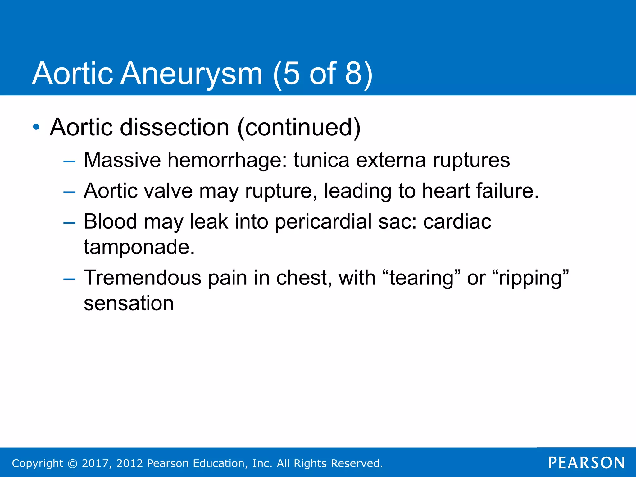 Copyright © 2017, 2012 Pearson Education, Inc. All Rights Reserved.
Aortic Aneurysm (5 of 8)
• Aortic dissection (continued)
– Massive hemorrhage: tunica externa ruptures
– Aortic valve may rupture, leading to heart failure.
– Blood may leak into pericardial sac: cardiac
tamponade.
– Tremendous pain in chest, with “tearing” or “ripping”
sensation
 