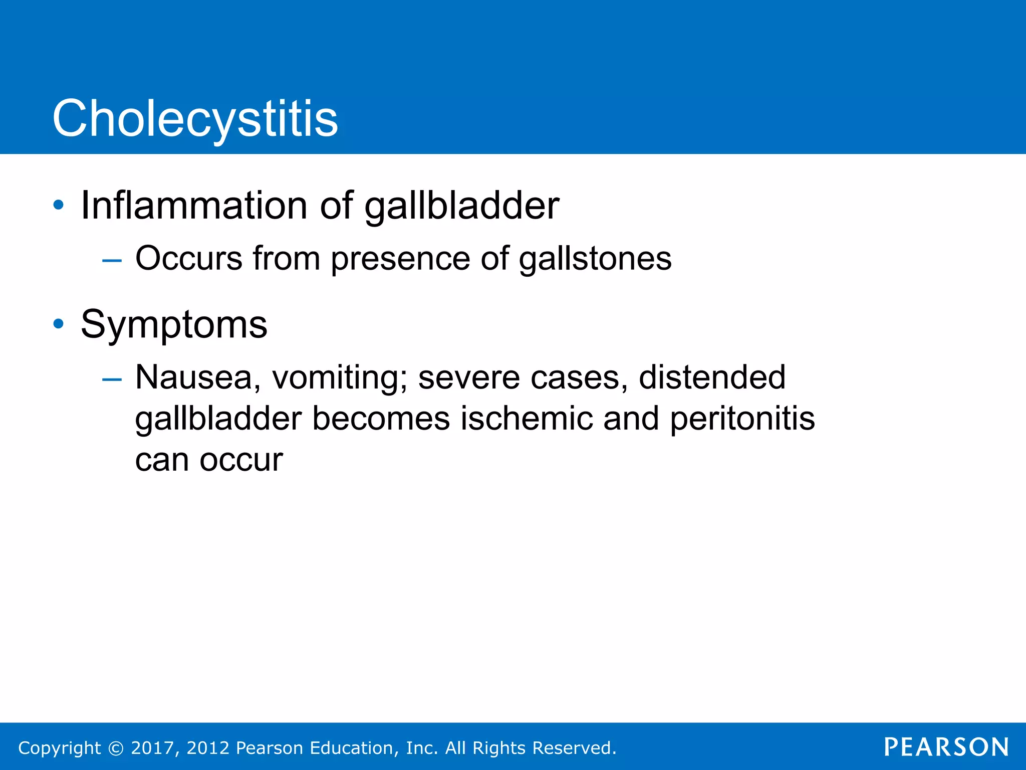 Copyright © 2017, 2012 Pearson Education, Inc. All Rights Reserved.
Cholecystitis
• Inflammation of gallbladder
– Occurs from presence of gallstones
• Symptoms
– Nausea, vomiting; severe cases, distended
gallbladder becomes ischemic and peritonitis
can occur
 