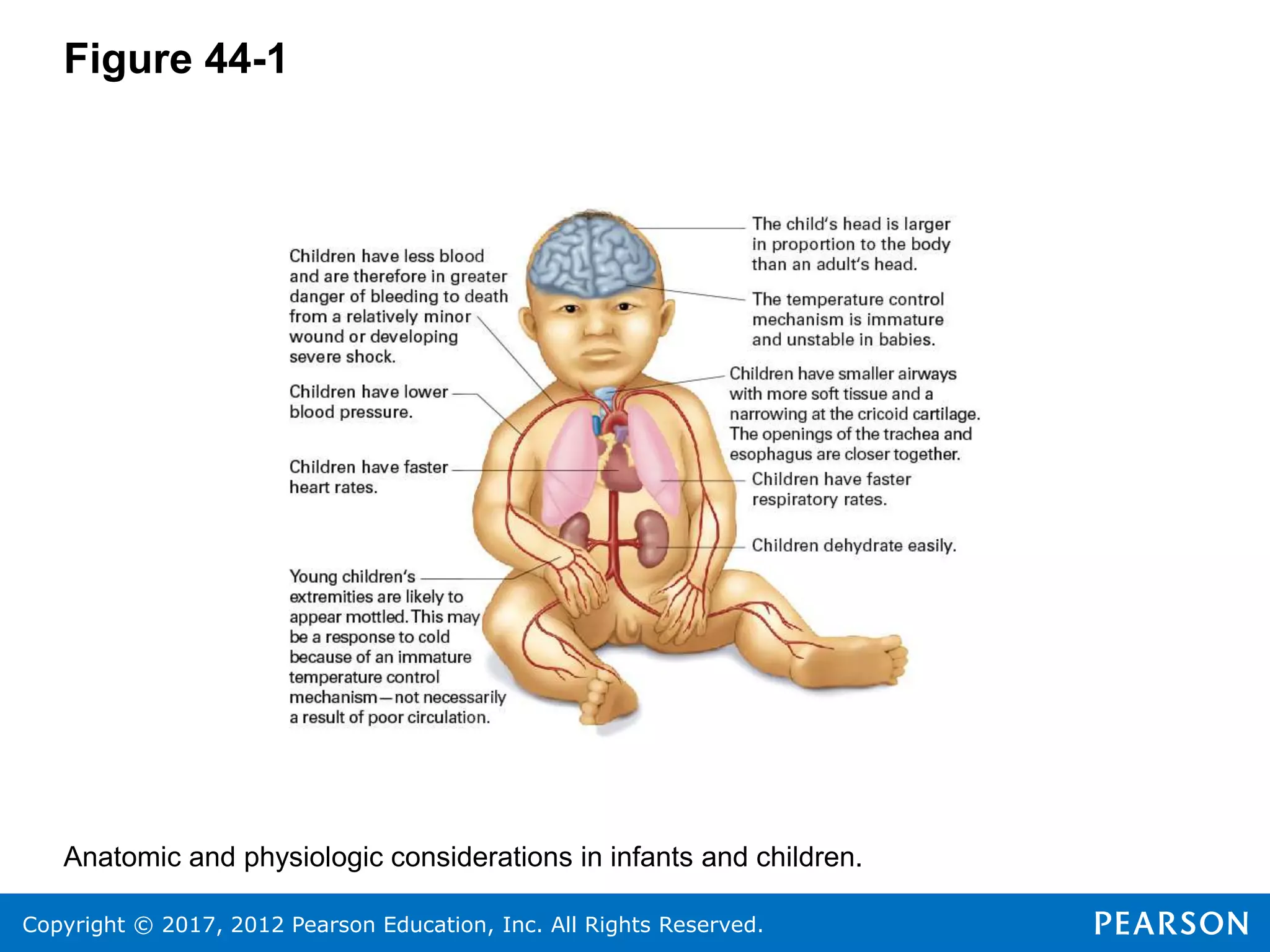 Copyright © 2017, 2012 Pearson Education, Inc. All Rights Reserved.
Figure 44-1
Anatomic and physiologic considerations in infants and children.
 