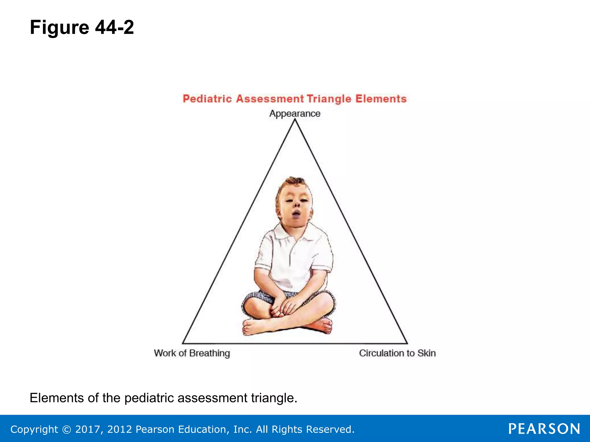 Copyright © 2017, 2012 Pearson Education, Inc. All Rights Reserved.
Figure 44-2
Elements of the pediatric assessment triangle.
 