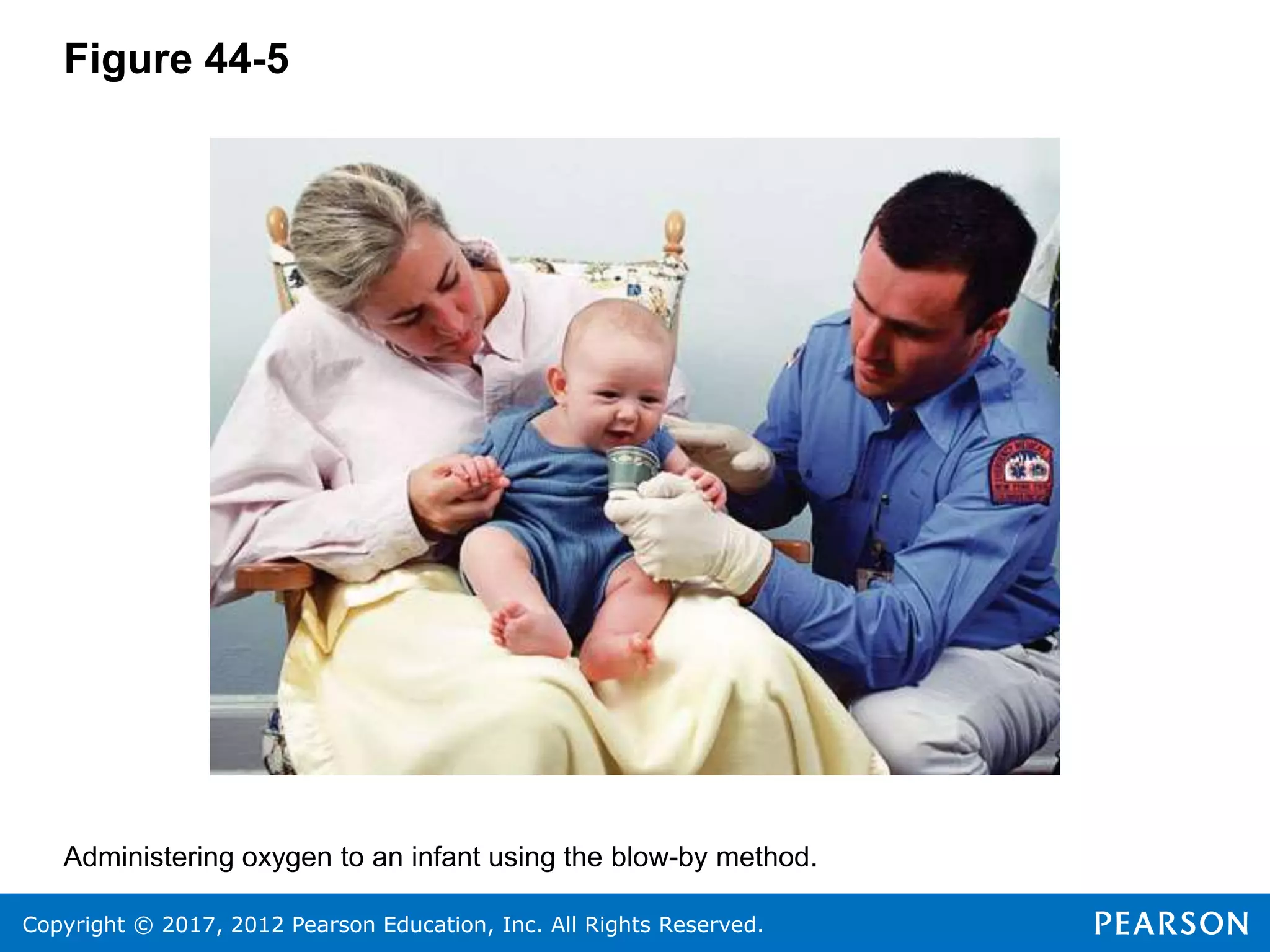 Copyright © 2017, 2012 Pearson Education, Inc. All Rights Reserved.
Figure 44-5
Administering oxygen to an infant using the blow-by method.
 