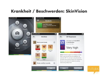 Krankheit / Beschwerden: SkinVision
 
