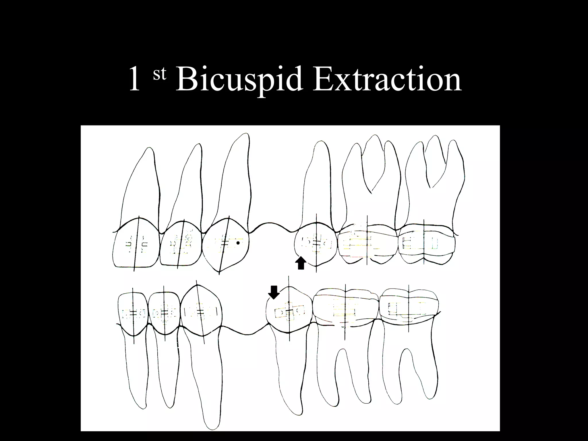 Alexanders vari simplex discipline | PPT